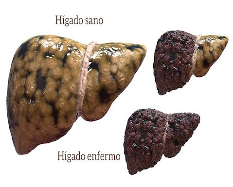 accion del alcohol en el cuerpo centros desintoxicación