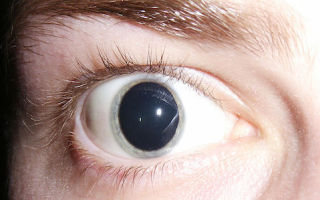 efectos del lsd efectos del lsd